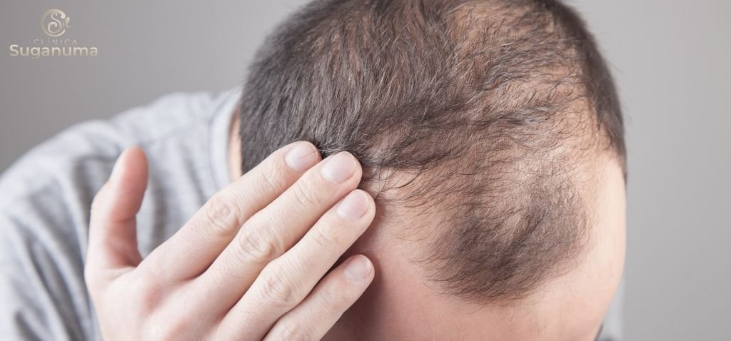 Como-tratar-a-falha-no-cabelo-de-forma-eficaz