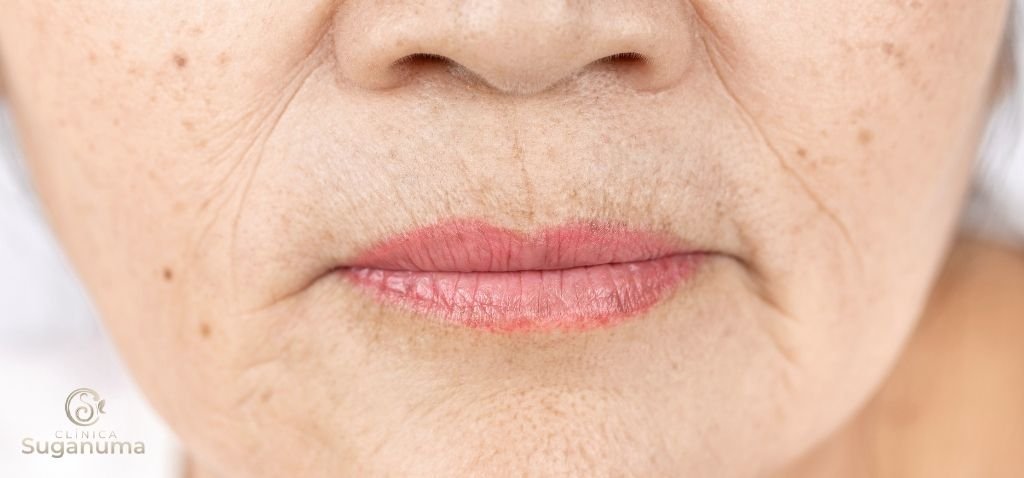 O-que-pode-causar-o-bigode-chinês-e-como-preveni-lo