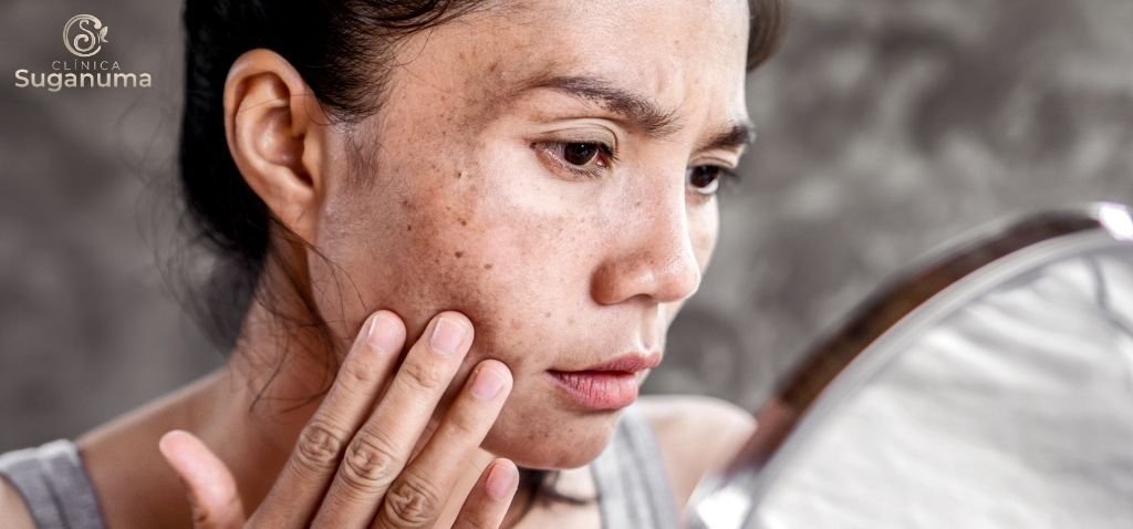 Como-tratar-as-manchas-do-rosto-de-forma-eficaz