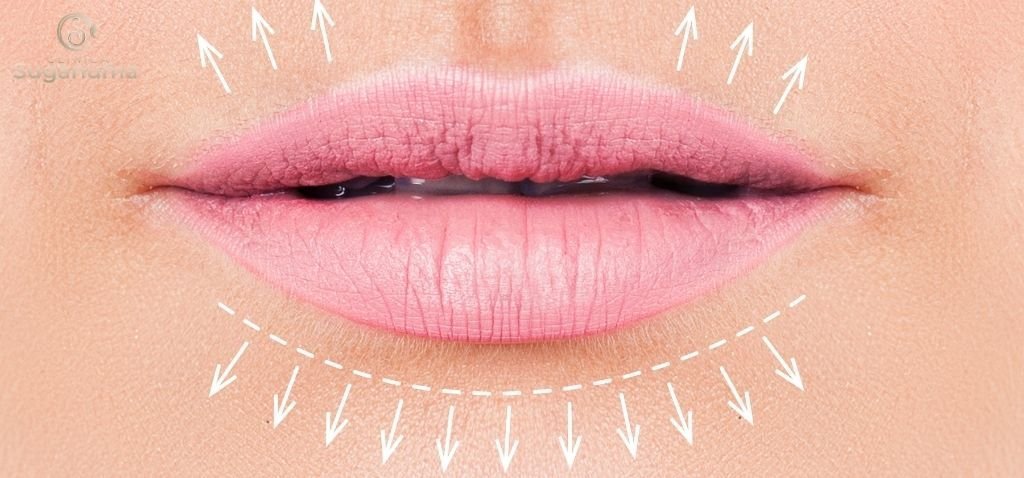 Existe-algum-tratamento-medico-disponivel-para-corrigir-ou-melhorar-o-afinamento-dos-labios