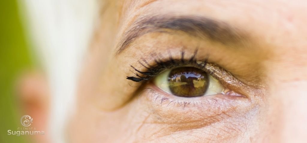 Os-tratamentos-para-a-flacidez-de-palpebras-sao-seguros-e-sem-riscos-para-a-saude