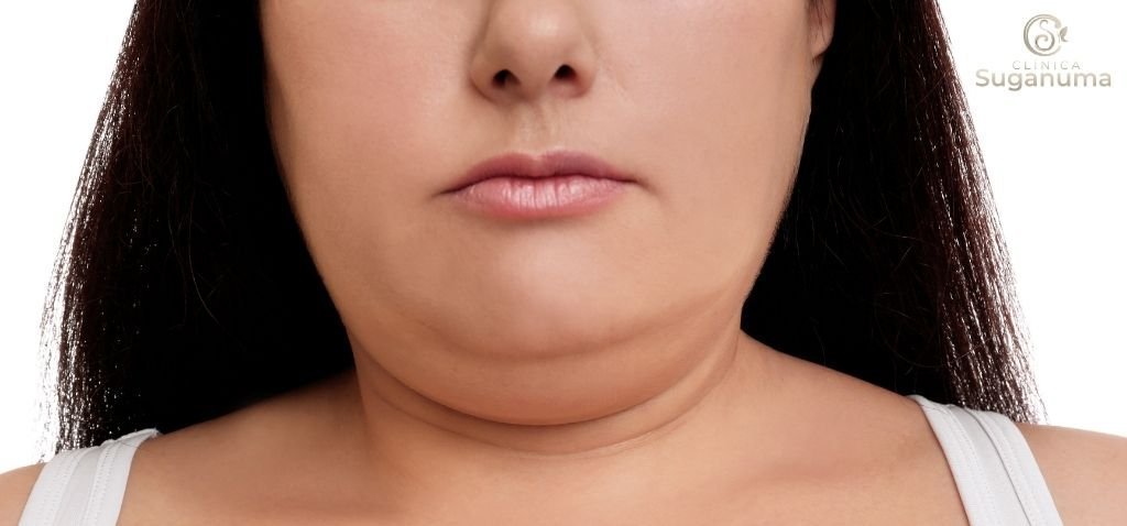 Existem-tratamentos-caseiros-para-o-rosto-redondo