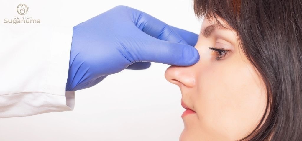 O-que-pode-causar-problemas-na-rinomodelacao-e-como-evita-los